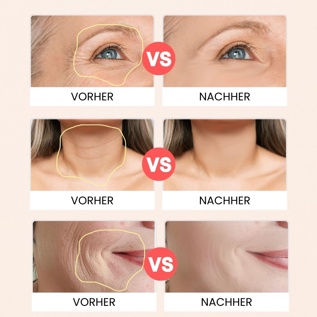 Navando | 5-In-1 Lifting Apparaat Voor Gezicht En Hals